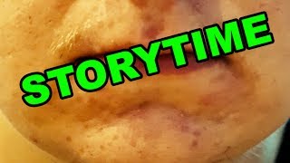 STORYTIME | Turhautuminen starttereihin 🦐 pikkukuva